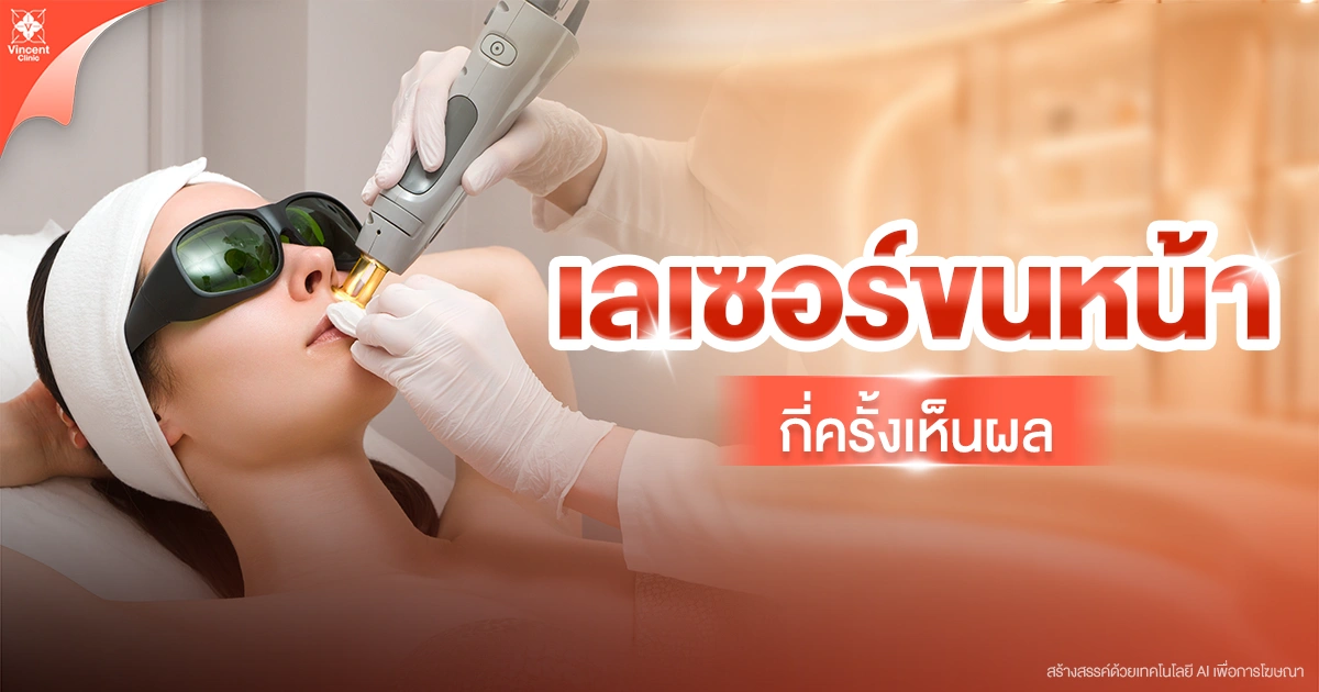 เลเซอร์ขนหน้ากี่ครั้งเห็นผล