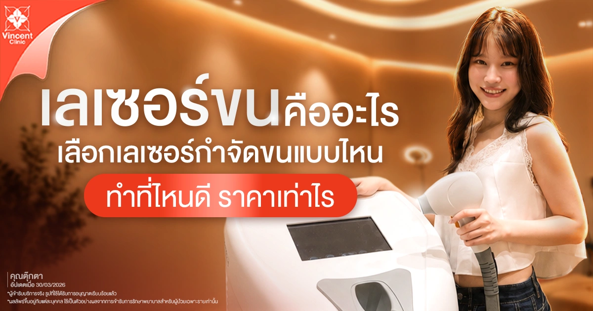 เลเซอร์ขน