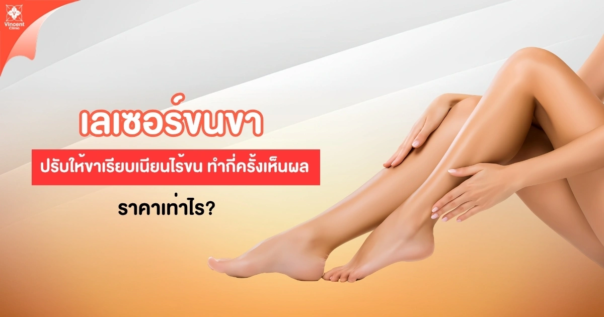 เลเซอร์ขนขา