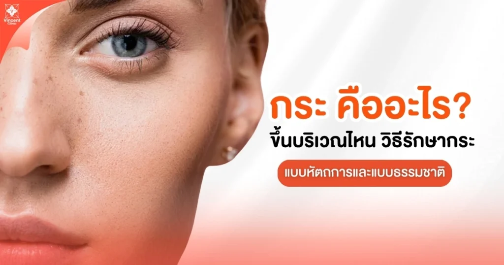 กระ คืออะไร