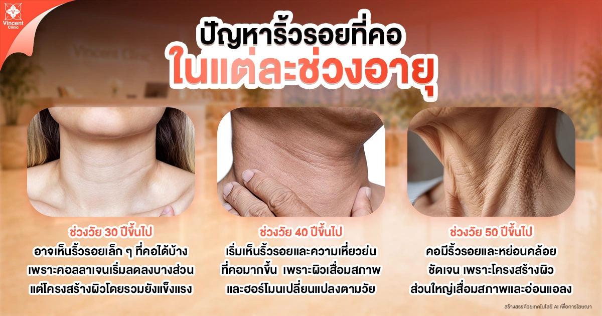 ปัญหาริ้วรอยที่คอในแต่ละช่วงอายุ