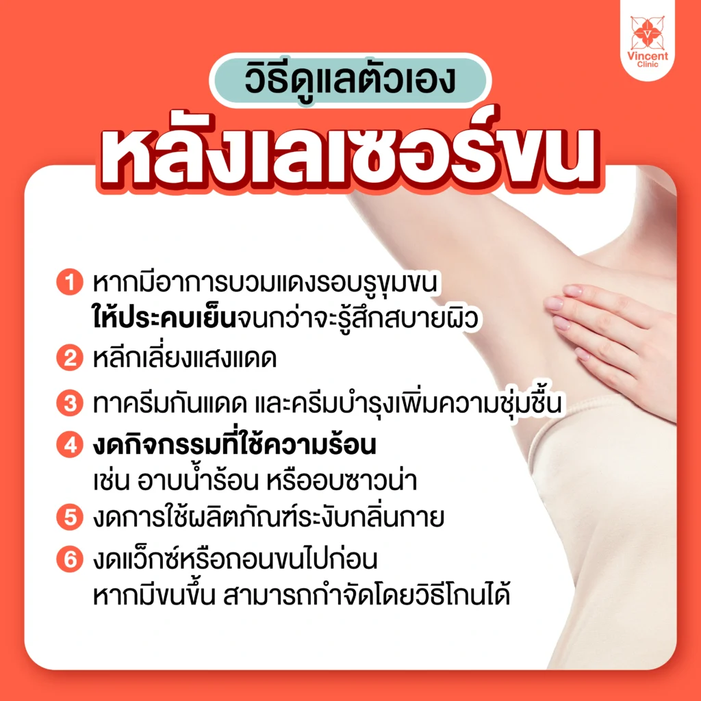 เลเซอร์ขนที่ไหนดี