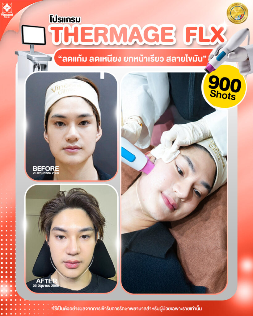 รีวิว thermage flx
