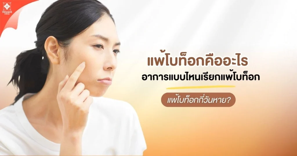 แพ้โบท็อก