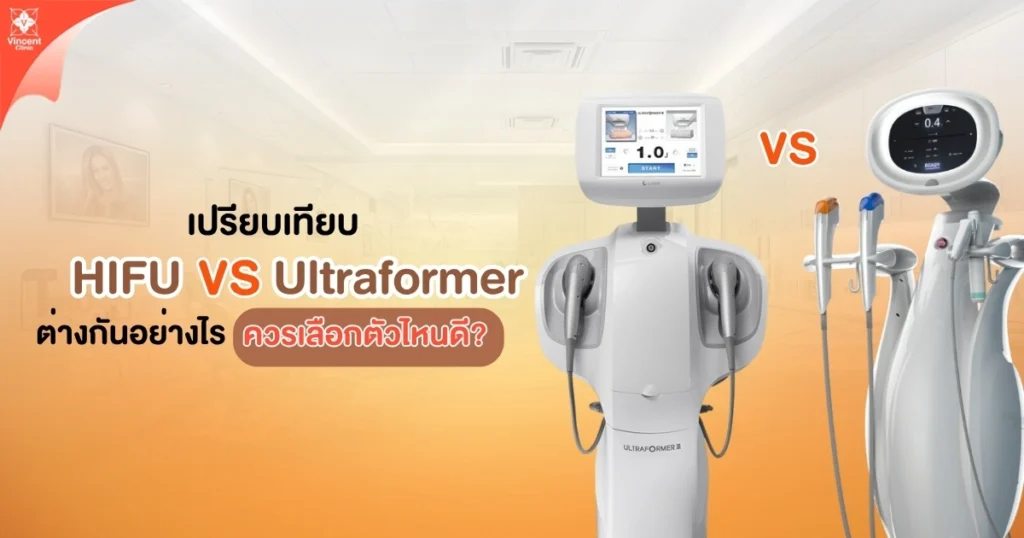 HIFU และ Ultraformer