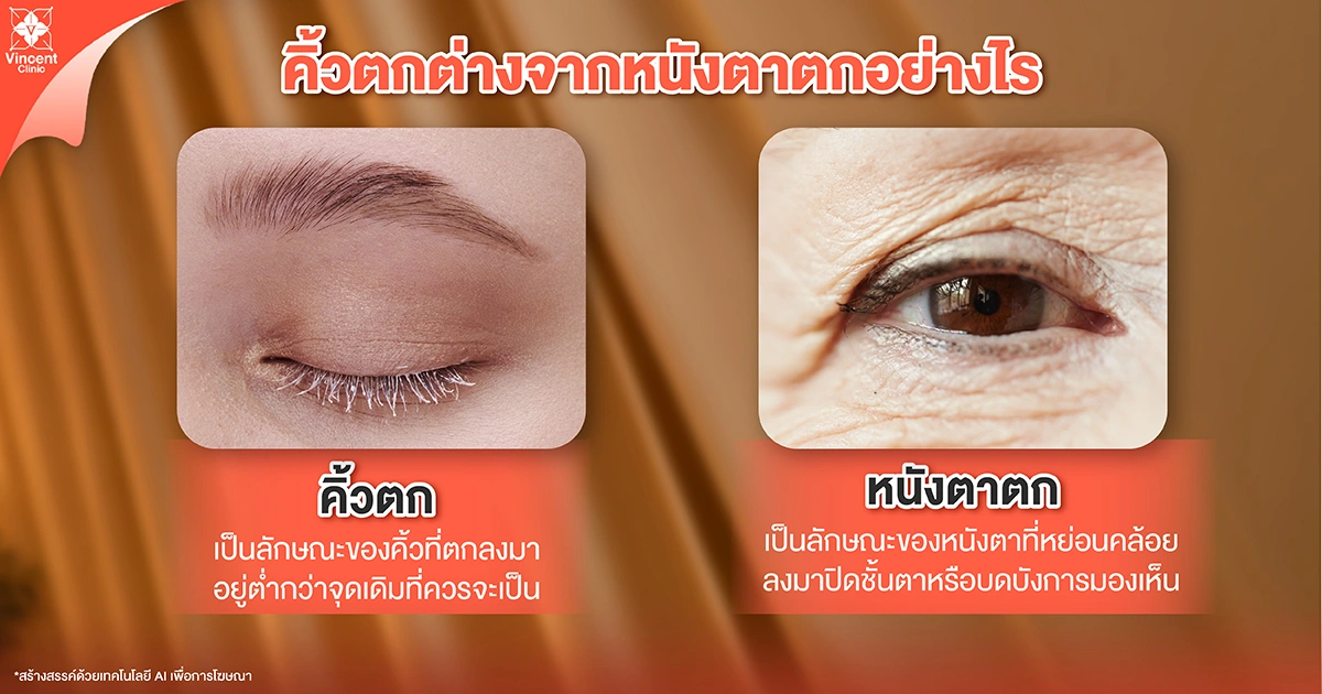 คิ้วตกต่างจากหนังตาตกอย่างไร