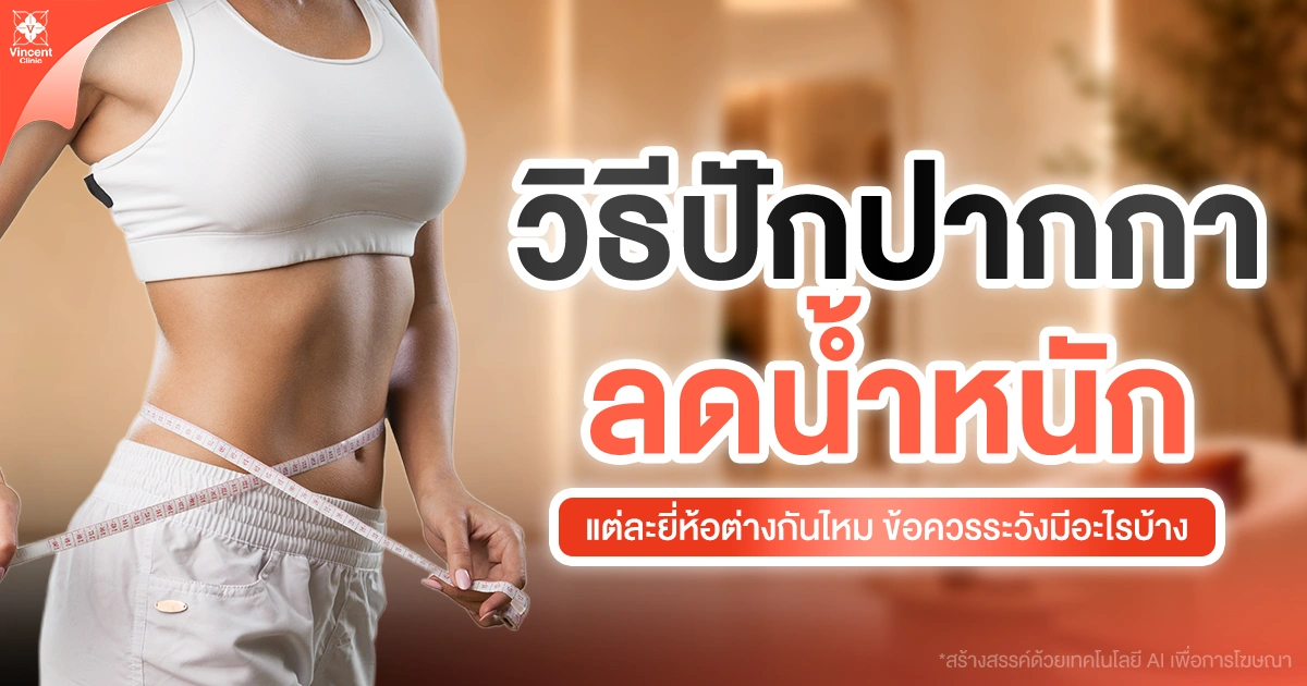วิธีปักปากกาลดน้ำหนัก