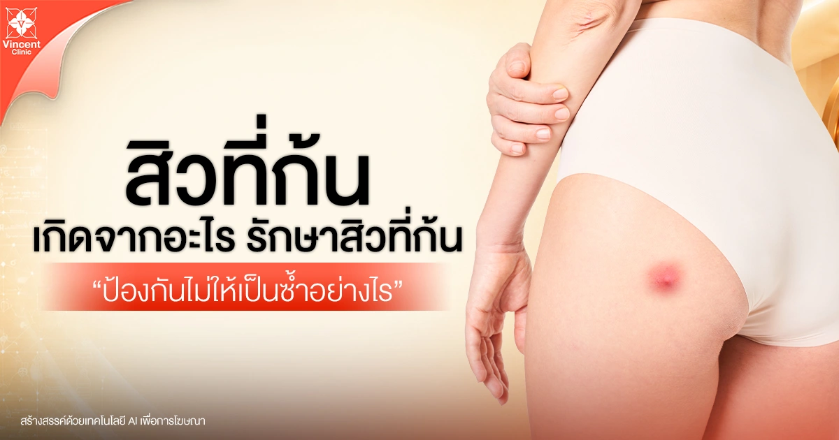 สิวที่ก้นเกิดจากอะไร?