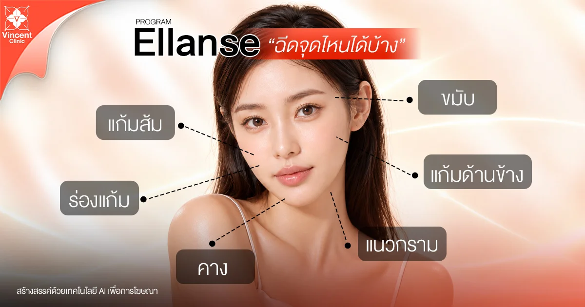 Which areas can be treated with Ellansé? Ellanse ฉีดจุดไหนได้บ้าง