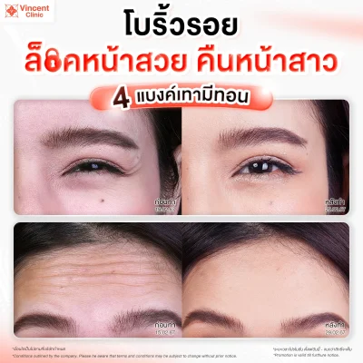 รีวิวโบริ้วรอย