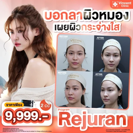 promotionRejuran
